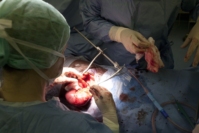 kidney transplant, take it intervention, health